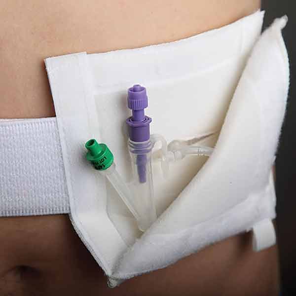 Medicina Gastrostomy Tidy Large 117cm-152.5cm