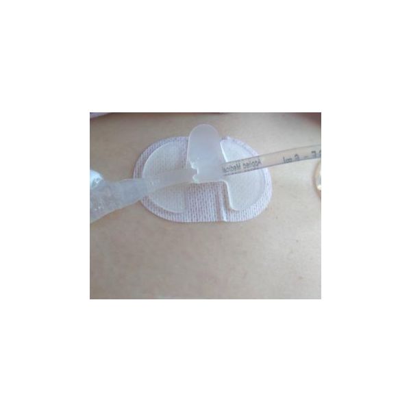 CINCH Tube Securement Device Box 10